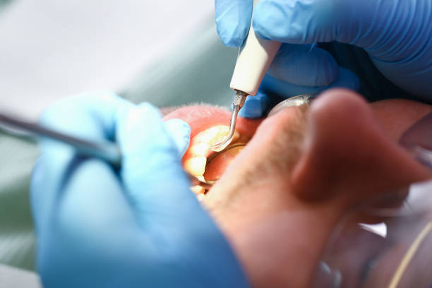 Best Mobile Emergency Dentist in North Beach, MD