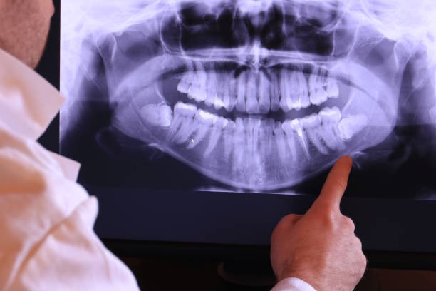 Best Holiday Emergency Dentist in North Beach, MD
