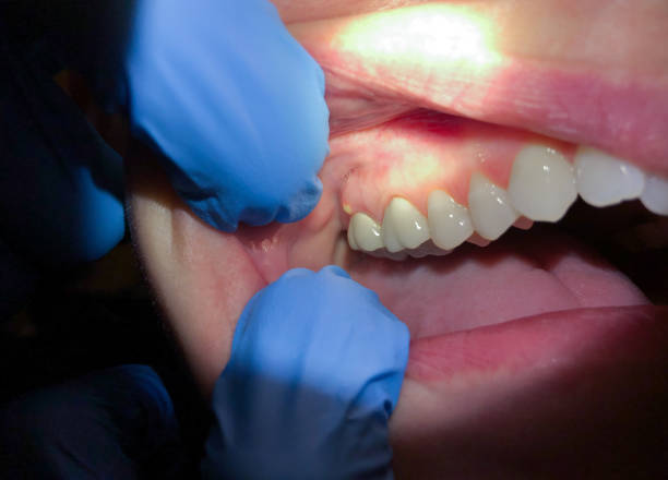  North Beach, MD Emergency Dentist Pros