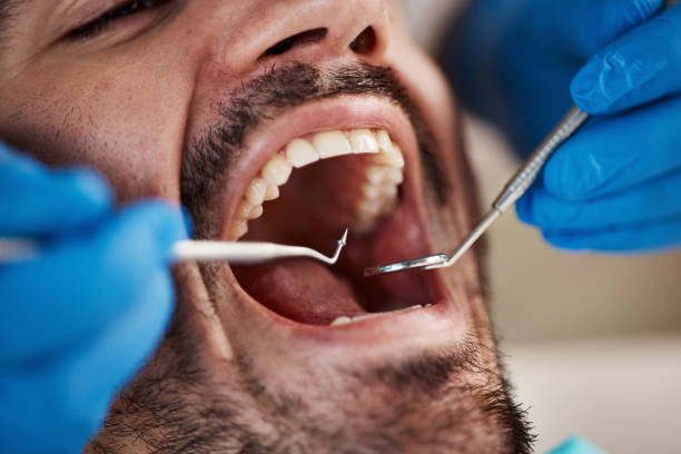 Best Emergency Cosmetic Dentistry in North Beach, MD