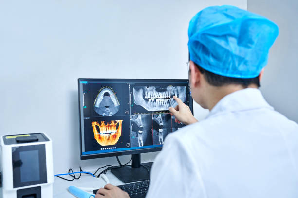 Best Emergency Dentist for Lost Fillings or Crowns in North Beach, MD