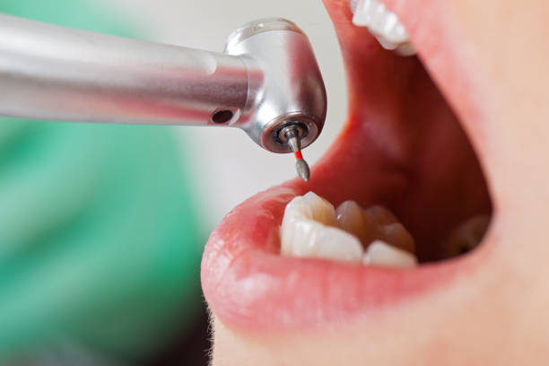 Best Emergency Dental Services for Seniors in North Beach, MD